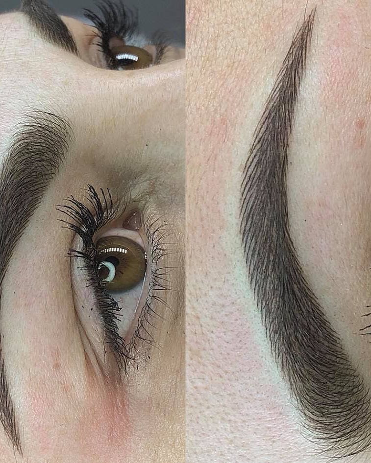 Wimpernkranzverdichtung
